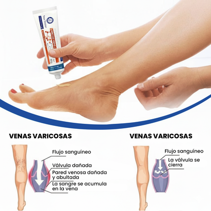 Crema Tratamiento para Venas – Tree Doctor